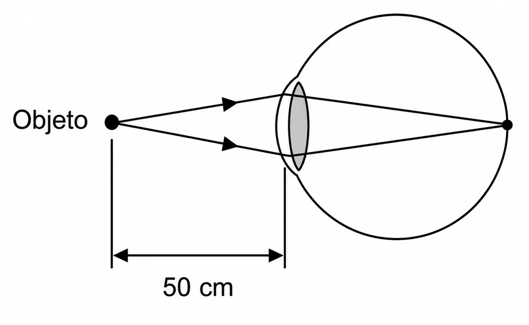 Objeto a 10 cm do olho, com os raios convergindo exatamente sobre a retina