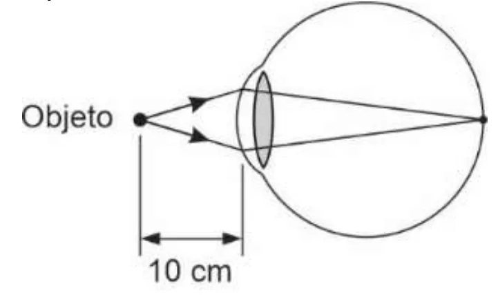 Objeto a 50 cm do olho, com os raios convergindo exatamente sobre a retina