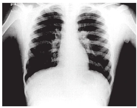 Radiografia do tórax.