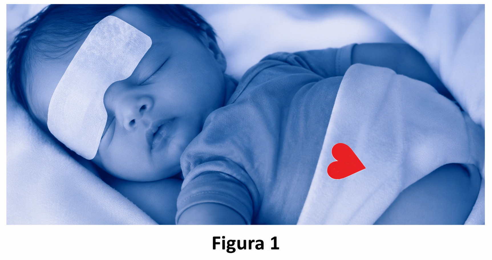 Figura 1 — recém-nascido em banho de luz azul, com sensor colado na fralda