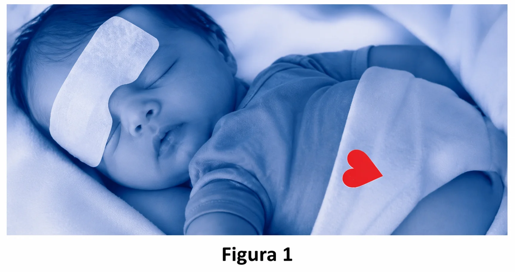 Figura 1 — recém-nascido em banho de luz azul, com sensor colado na fralda