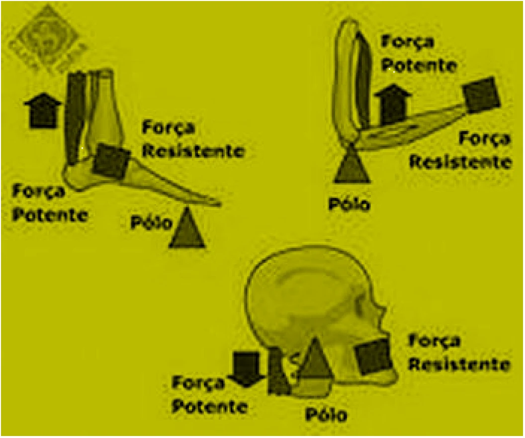 Figura da questão 31 de Física — EMESCAM 2012.2