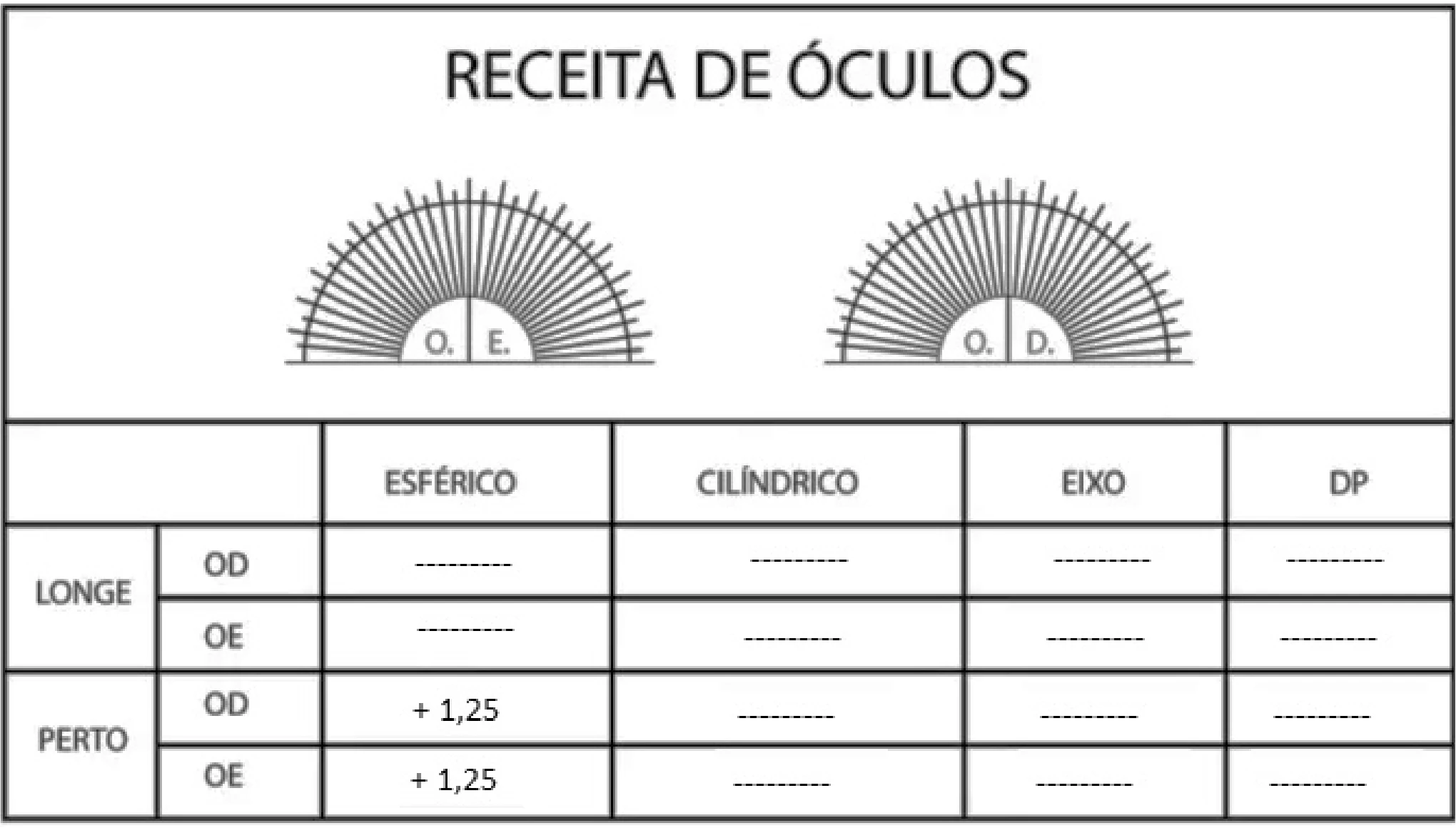 Receita de óculos com grau esférico +1,25 em ambos os olhos apenas para perto — questão 40 de Física, EMESCAM 2025.2