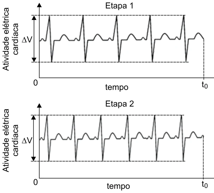 Dois gráficos de atividade elétrica cardíaca em função do tempo, Etapa 1 com 5 batimentos até t0 e Etapa 2 com mais batimentos no mesmo intervalo, ambos com a mesma variação ΔV