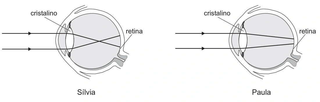 Olhos de Sílvia e Paula: foco antes e depois da retina, respectivamente.
