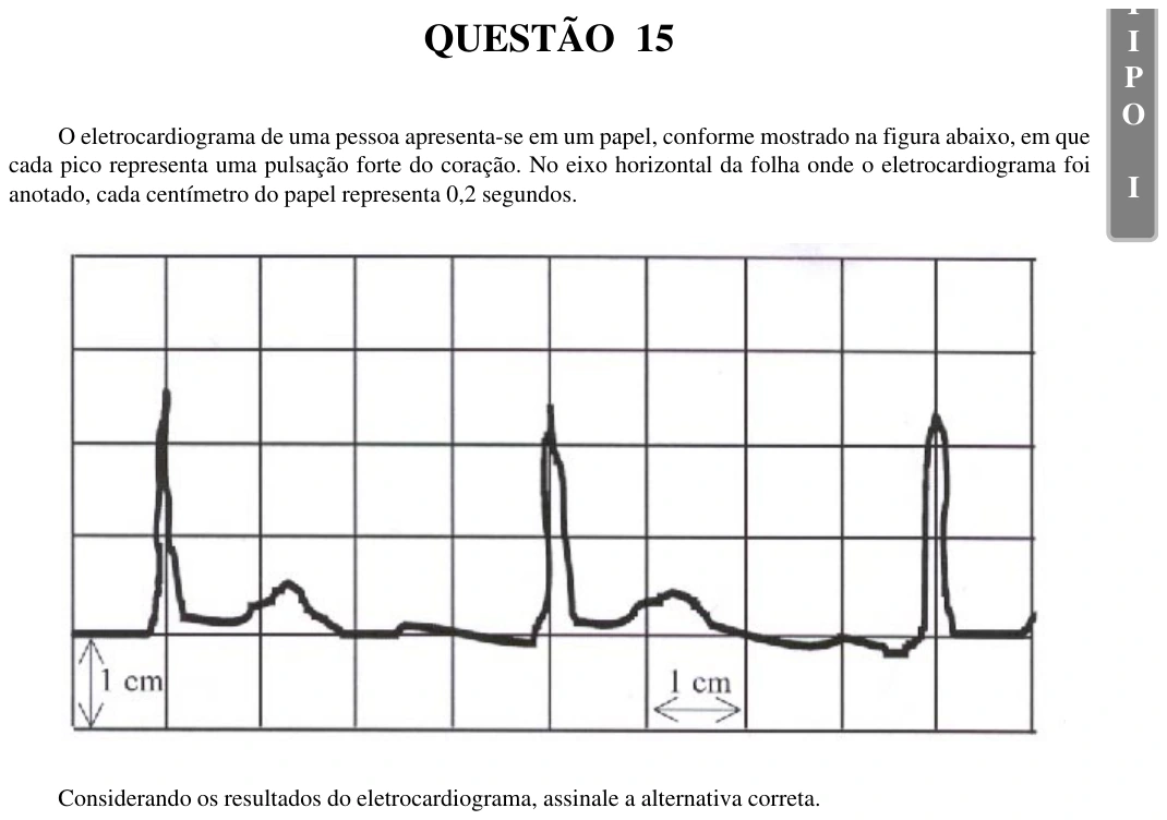 UFU 2002.1, questão 15: I P O I QUESTÃO 15 O eletrocardiograma de uma pessoa apresenta-se em um papel, conforme mostrado na figura abaixo, em que cada pico representa uma pulsação forte do coraç