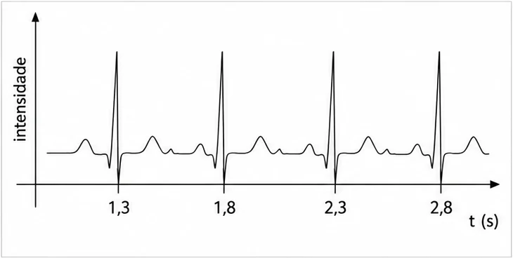 Eletrocardiograma com intensidade dos impulsos cardíacos em função do tempo