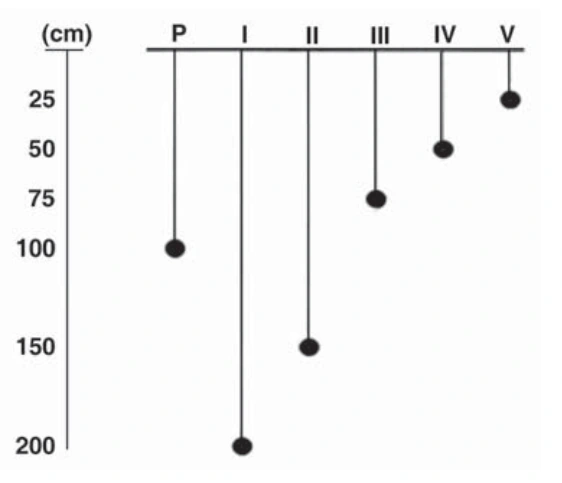Pêndulos de comprimentos P = 100 cm, I = 200 cm, II = 150 cm, III = 75 cm, IV = 50 cm e V = 25 cm.