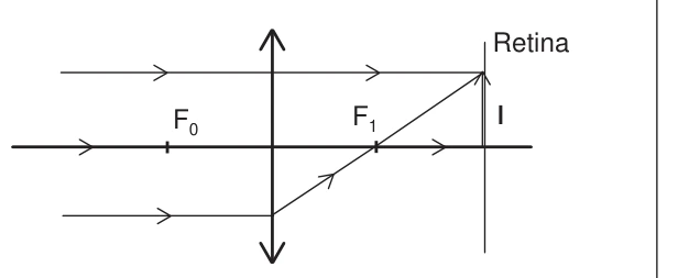 Raios paralelos desenhados com imagem direita na retina.