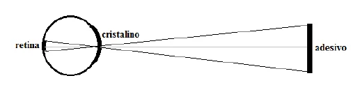 Esquema do olho: retina à esquerda, cristalino ao centro e adesivo à direita, com os raios cruzando-se no cristalino