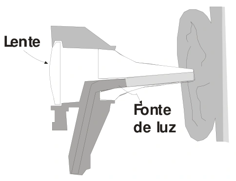 Otoscópio com lente de aumento e fonte de luz voltadas para o interior da orelha.
