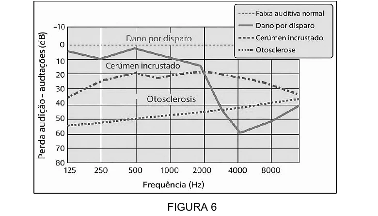 Audiograma comparando dano por disparo, cerúmen incrustado e otosclerose em diferentes frequências