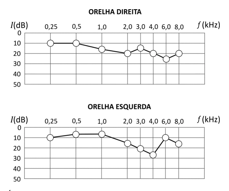 Gráficos de audiometria das orelhas direita e esquerda em função da frequência