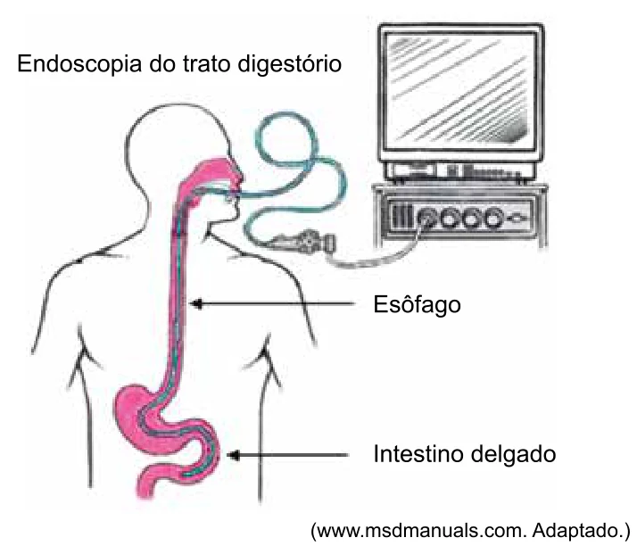 Endoscopia do trato digestório com transmissão da imagem por fibra óptica.
