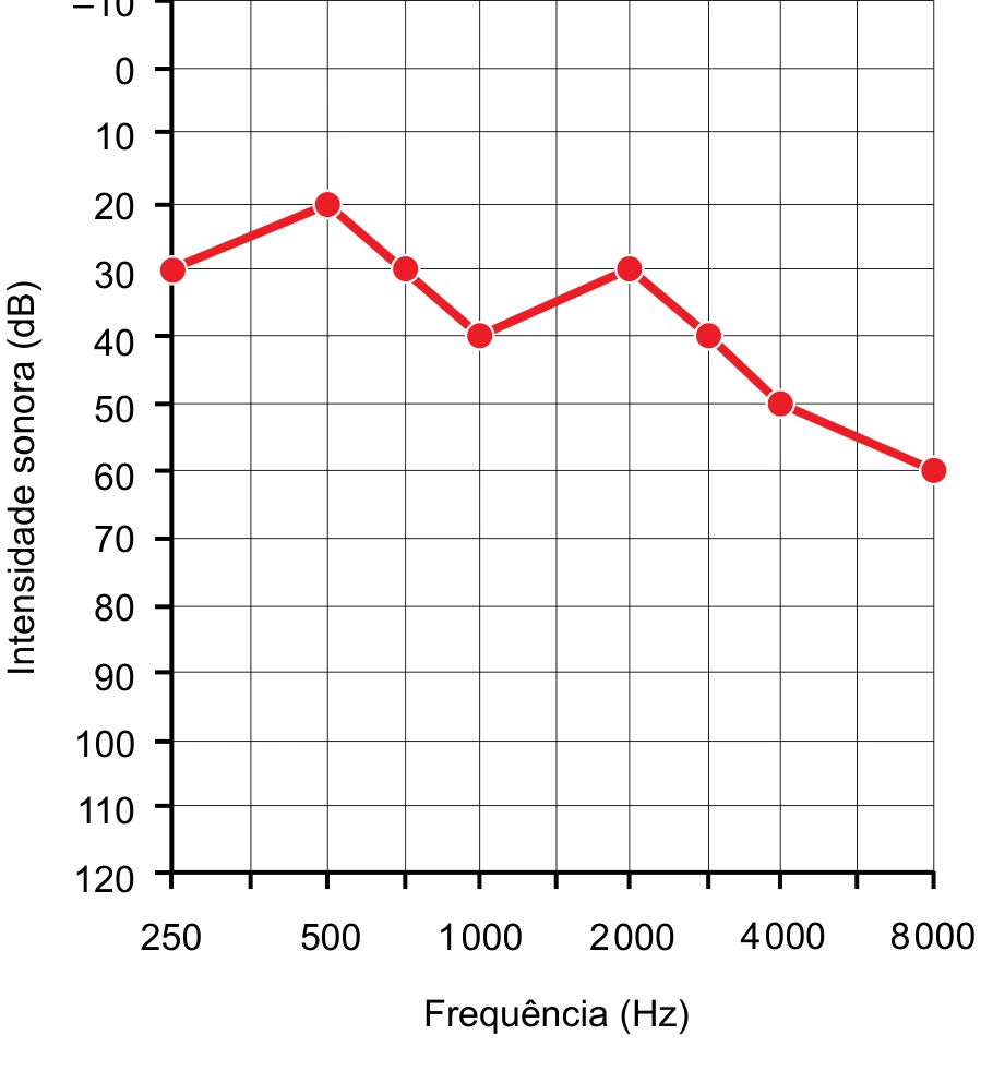 Gráfico de audiometria com intensidade sonora em função da frequência