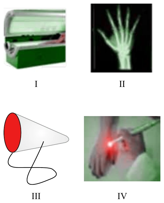Quatro figuras: I, equipamento fechado em forma de cabine com lâmpadas internas; II, radiografia de uma mão; III, lâmpada em forma de cone com a abertura vermelha e fio elétrico; IV, aplicação de um feixe de luz concentrada sobre a mão de um paciente